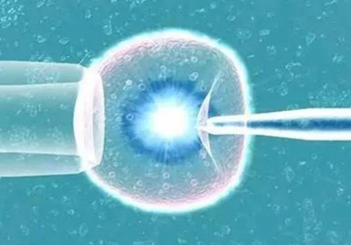 杭州供卵试管：﻿? 多囊卵巢怎么要孩子快，多囊卵巢怀孕后注意这些对身体更有好处